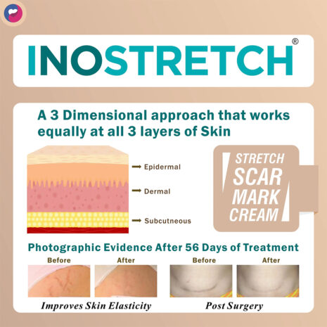 Inostretch-1.jpg-filenameUTF-8Inostretch201.jpg